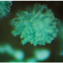 Mold on neglected kombucha mother with stereoscope