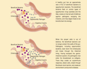 Drawings of a healthy gut and an unhealthy gut 