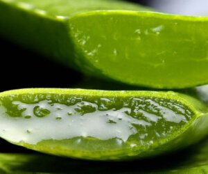 remedies for burns
