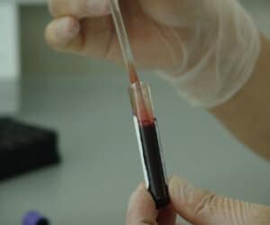blood sample